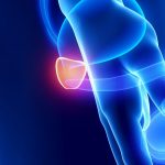 Câncer de próstata: tratamentos e cirurgia robótica